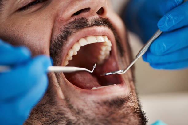 Best Root Canal Emergency Dentist  in South Roxana, IL